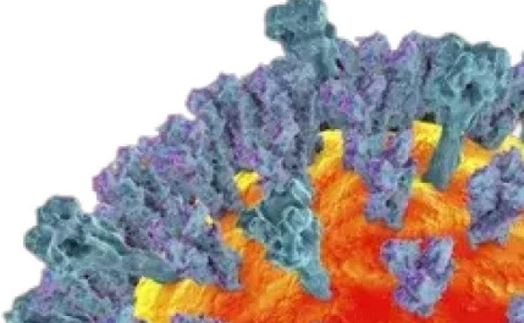 Measles in Texas: Frontera weighs in